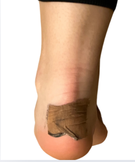 Blister Protection en Pointe